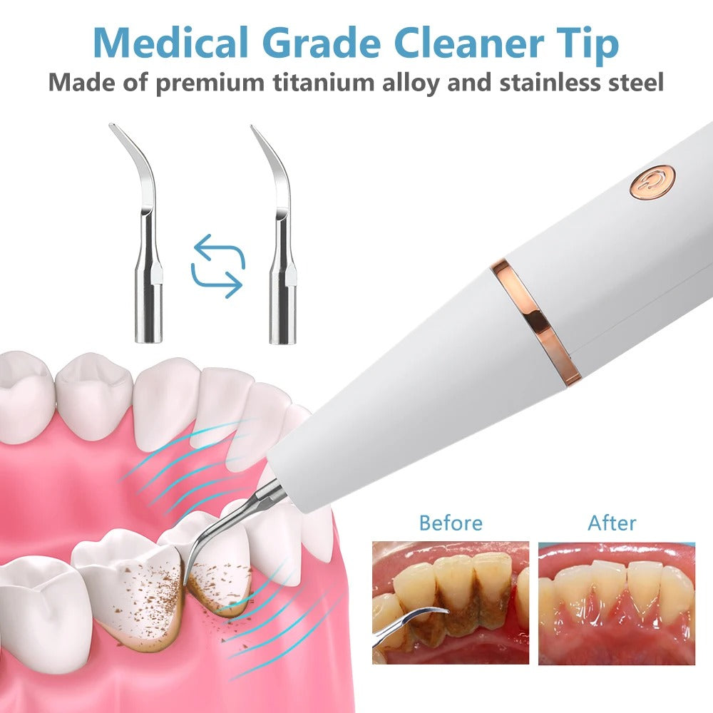 Ultrasonic Dental Scaler