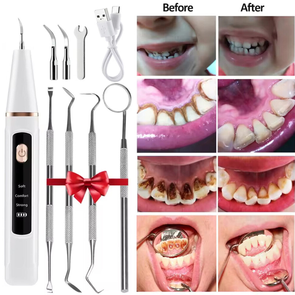 Ultrasonic Dental Scaler