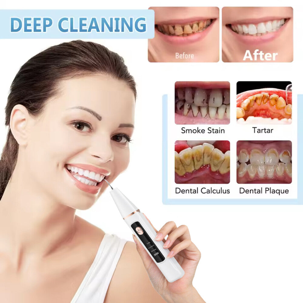 Ultrasonic Dental Scaler